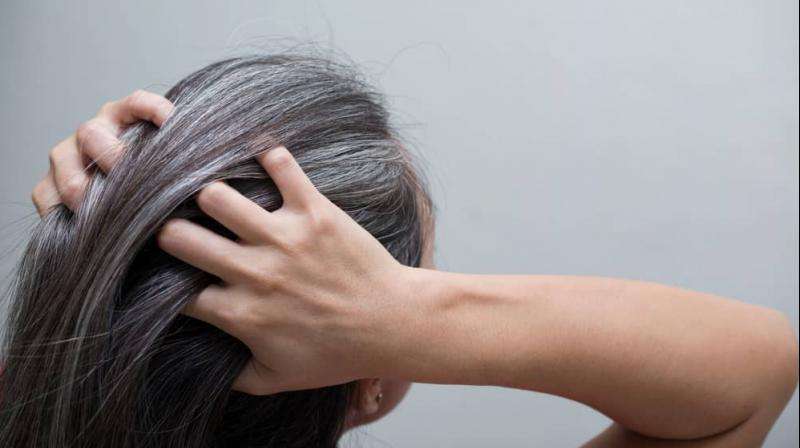 Know the Causes of White Hair and Easy Ways to Prevent It Naturally