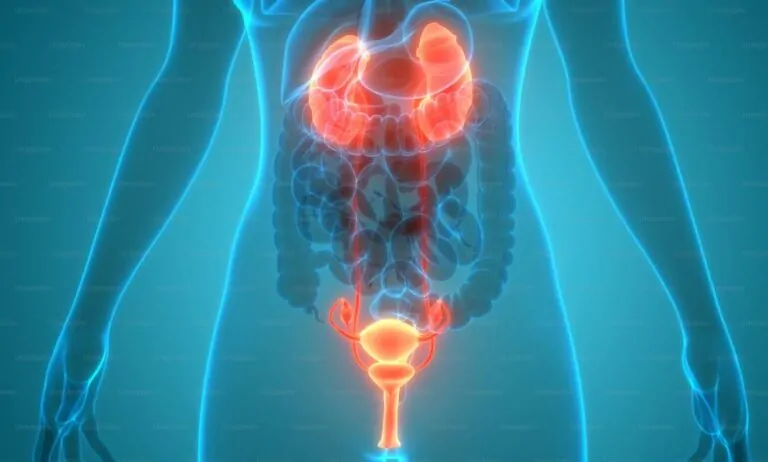 Urinary Tract Infection (UTI) in Females