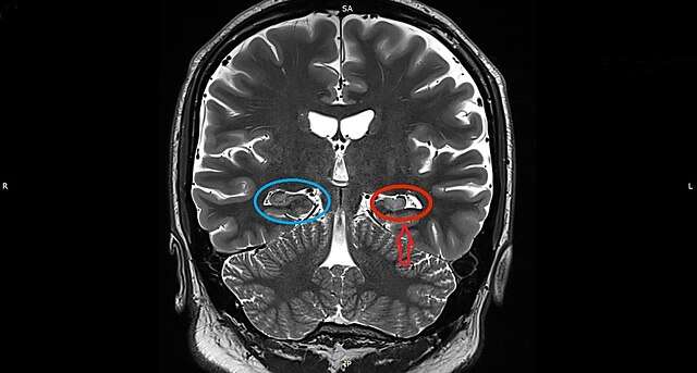 clinical significance