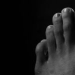 diabetic foot ulcers
