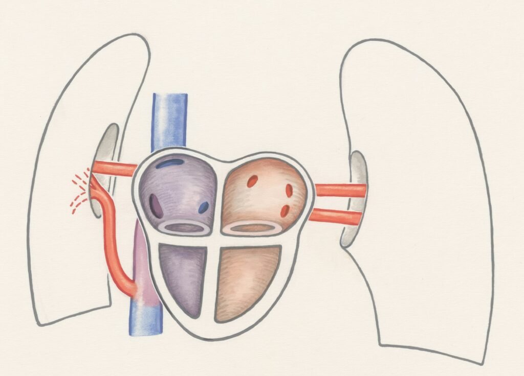 understanding pcos